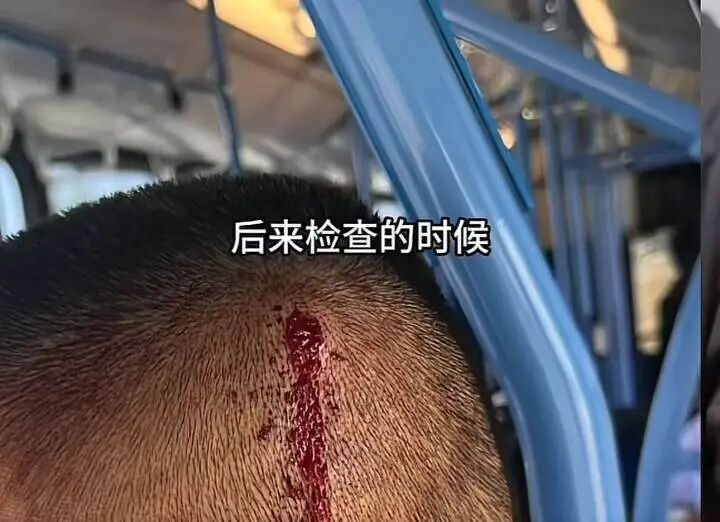 RoyRz, 周润琪被另 RoyRz, 周润琪被另